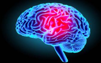 Abcès du cerveau secondaires à une méningite à Salmonella spp chezl'enfant Pr Ndèye Rama,Dr Basse,Dr Dina,Dr Ndiémé,Dr Guèye